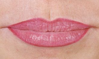 Lippenkonturierung