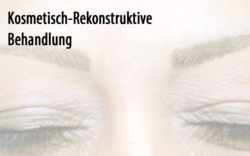 Kosmetisch-Rekonstruktive Behandlung