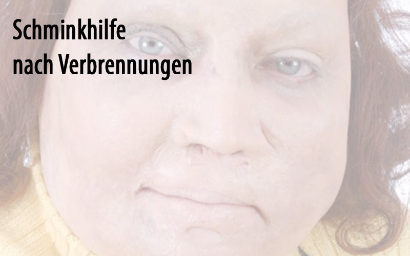 Schminkhilfe nach Verbrennungen