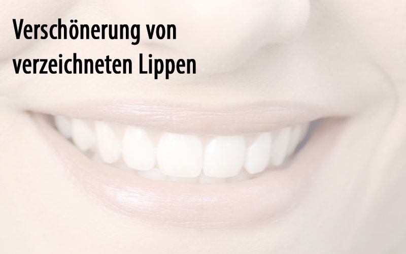 Verschönerung von verzeichneten Lippen